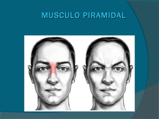 MUSCULO PIRAMIDALMUSCULO PIRAMIDAL
 
