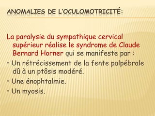 ANOMALIES DE L’OCULOMOTRICITÉ:



La paralysie du sympathique cervical
  supérieur réalise le syndrome de Claude
  Bernard Horner qui se manifeste par :
• Un rétrécissement de la fente palpébrale
  dû à un ptôsis modéré.
• Une énophtalmie.
• Un myosis.
 