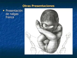 Otras Presentaciones Presentación de nalgas franca 