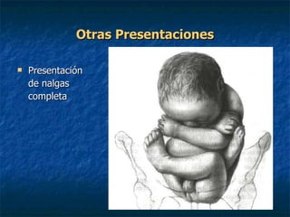 Otras Presentaciones Presentación  de nalgas  completa 