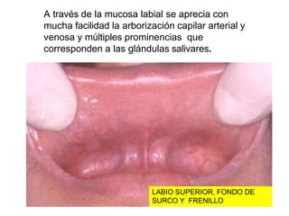 A través de la mucosa labial se aprecia con
mucha facilidad la arborización capilar arterial y
venosa y múltiples prominencias que
corresponden a las glándulas salivares.
LABIO SUPERIOR, FONDO DE
SURCO Y FRENILLO
 