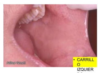 • CARRILL
O
IZQUIER
 