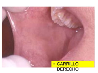• CARRILLO
DERECHO
 