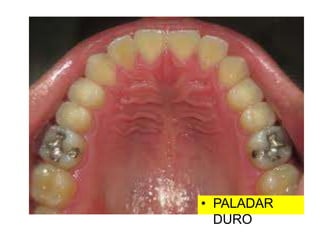 • PALADAR
DURO
 
