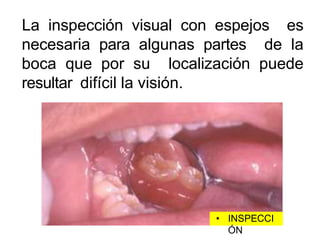 La inspección visual con espejos es
necesaria para algunas partes de la
boca que por su localización puede
resultar difícil la visión.
• INSPECCI
ÓN
 