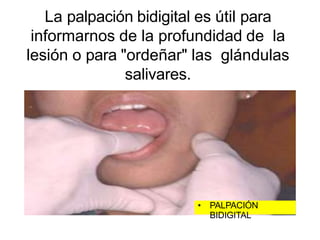 La palpación bidigital es útil para
informarnos de la profundidad de la
lesión o para "ordeñar" las glándulas
salivares.
• PALPACIÓN
BIDIGITAL
 