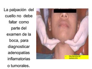 La palpación del
cuello no debe
faltar como
parte del
examen de la
boca, para
diagnosticar
adenopatías
inflamatorias
o tumorales.
• PALPACIÓN DE
GANGLIOS
 