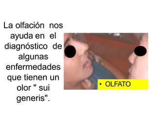 La olfación nos
ayuda en el
diagnóstico de
algunas
enfermedades
que tienen un
olor " sui
generis".
• OLFATO
 