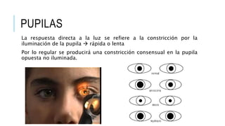 PUPILAS
La respuesta directa a la luz se refiere a la constricción por la
iluminación de la pupila  rápida o lenta
Por lo regular se producirá una constricción consensual en la pupila
opuesta no iluminada.
 