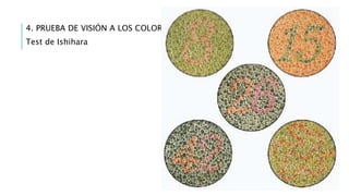4. PRUEBA DE VISIÓN A LOS COLORES
Test de Ishihara
 