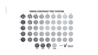 Examen oftalmológico