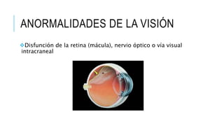 ANORMALIDADES DE LA VISIÓN
Disfunción de la retina (mácula), nervio óptico o vía visual
intracraneal
 
