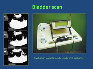 Bladder scan




Evaluation instantanée du résidu post mictionnel
 