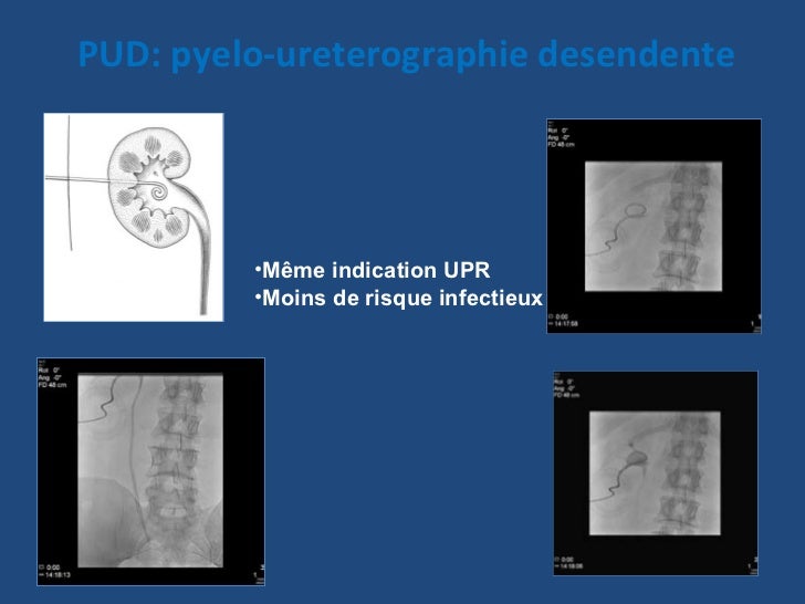 ’Examen para clinique en urologie 2 ’Examen para clinique en urologie 2