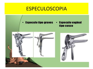 ESPECULOSCOPIA
 