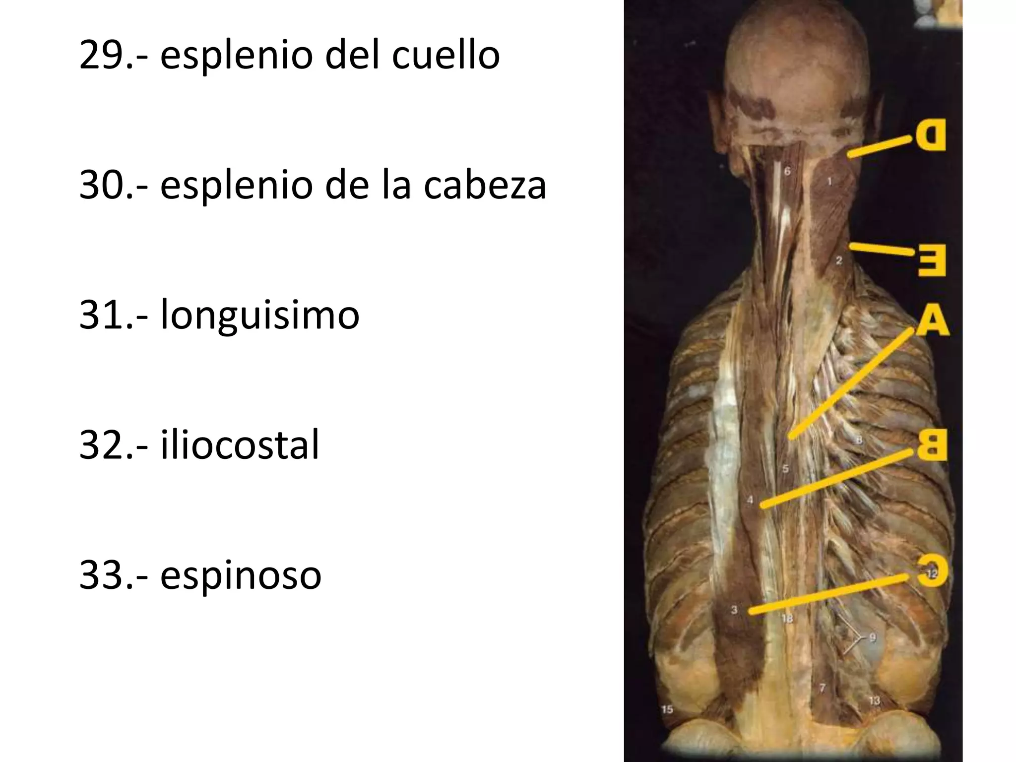 29.- esplenio del cuello
30.- esplenio de la cabeza
31.- longuisimo
32.- iliocostal
33.- espinoso
 