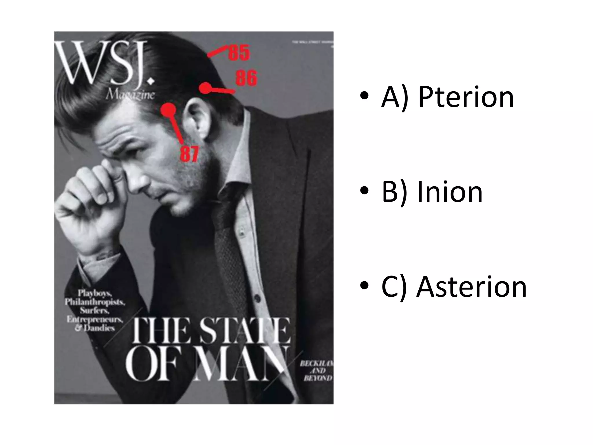 • A) Pterion
• B) Inion
• C) Asterion
 