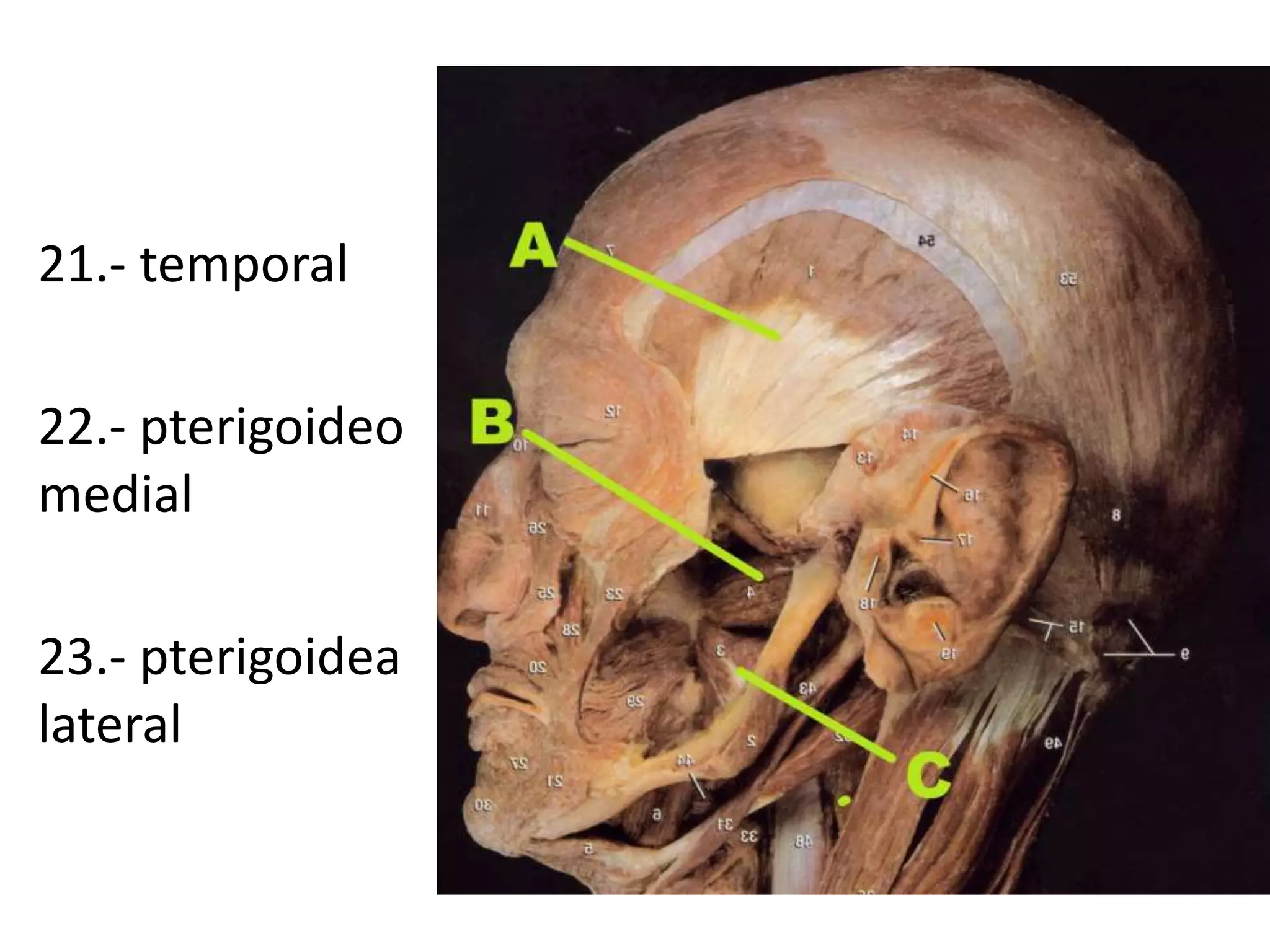 21.- temporal
22.- pterigoideo
medial
23.- pterigoidea
lateral
 