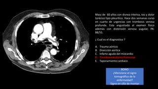 Torax Ex EXAMEN RX TORAX COLUMBUS.pptx