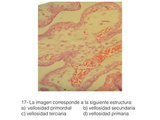 17- La imagen corresponde a la siguiente estructura:
a) vellosidad primordial b) vellosidad secundaria
c) vellosidad terciaria d) vellosidad primaria
 