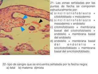 21- Las zonas señaladas por las
puntas de ﬂecha se componen
estructuralmente por:
a) s i n c i t i o t r o f o b l a s t o +
citotofoblasto + mesodermo
b) s i n c i t i o t r o f o b l a s t o +
mesodermo + endotelio
c) citotrofoblasto + membrana
basal del citotrofoblasto +
endotelio + membrana basal
del endotelio
d) endotelio + membrana basal
d e l e n d o t e l i o +
sincitiotrofoblasto + membrana
basal del sincitiotrofoblasto.
22- tipo de sangre que se encuentra señalada por la ﬂecha negra:
a) fetal b) materna d)mixta
 