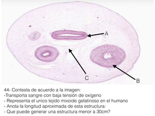 44- Contesta de acuerdo a la imagen:
-Transporta sangre con baja tensión de oxigeno
- Representa el unico tejido mixoide gelatinoso en el humano
- Anota la longitud aproximada de esta estructura:
- Que puede generar una estructura menor a 30cm?
B
A
C
 