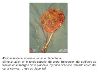 45- Causa de la siguiente variante placentaria:
a)implantación en el tercio superior del útero b)inserción del pedículo de
ﬁjación en el margen de la placenta c)corion frondoso formado cerca del
canal cervical d)eso es placenta?
 
