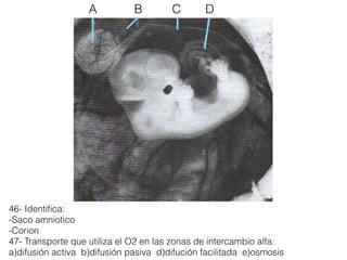 46- Identiﬁca:
-Saco amniotico
-Corion
47- Transporte que utiliza el O2 en las zonas de intercambio alfa:
a)difusión activa b)difusión pasiva d)difución facilitada e)osmosis
A B C D
 