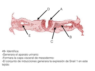A
BE
49- Identiﬁca:
-Generara el aparato urinario:
-Formara la capa visceral de mesodermo:
-El conjunto de inducciones generara la expresión de Snail 1 en este
tejido:
D
C
 