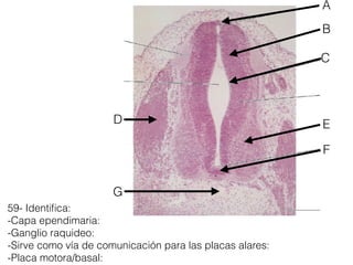 59- Identiﬁca:
-Capa ependimaria:
-Ganglio raquideo:
-Sirve como vía de comunicación para las placas alares:
-Placa motora/basal:
C
G
D
B
A
F
E
 