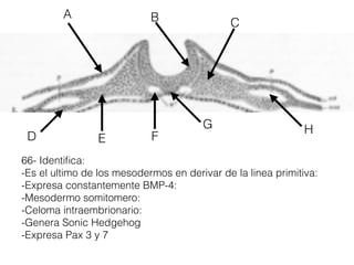 66- Identiﬁca:
-Es el ultimo de los mesodermos en derivar de la linea primitiva:
-Expresa constantemente BMP-4:
-Mesodermo somitomero:
-Celoma intraembrionario:
-Genera Sonic Hedgehog
-Expresa Pax 3 y 7
BA
HG
F
C
ED
 