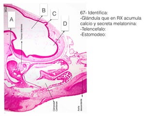 67- Identiﬁca:
-Glándula que en RX acumula
calcio y secreta melatonina:
-Telencefalo:
-Estomodeo:
A
B
D
C
 