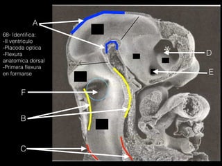 A
B
C
D
E
F
68- Identiﬁca:
-II ventrículo
-Placoda optica
-Flexura
anatomica dorsal
-Primera ﬂexura
en formarse
 
