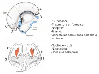 A
B
D
C
F
I
H
E
G
69- Identiﬁca:
-1ª comisura en formarse:
-Neopalio:
-Talamo:
-Conecta los hemisferios derecho e
izquierdo:
-Nucleo lenticular:
-Neocorteza:
-Comisura habenular
 