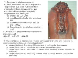 71-De acuerdo a la imagen que se
muestra, escriba su impresión diagnostica:
-Suponiendo que usted hubiese sido el
medico tratante de esta paciente, que
estudios hubiese pedido para poder
diagnosticar esta patología?
a) análisis de LCR y RX
b) cuantiﬁcación de alfa-feto-proteina y
RM
c) cuantiﬁcación de fracción beta de
GCH y USG
d) Cuantiﬁcación de alfa-feto-proteina y
USG
72- En que dias probablemente hubo falla en
el cierre neural:
a) 24-25 b) 21-22 c) 26-27
73- Suponiendo que la madre quiere volverse a embarazar el próximo año, cual seria su
recomendación médica para evitar esta patología?
a) uso proﬁláctico de 4mg de ac. fólico durante el 1er trimestre de embarazo
b) uso proﬁláctico de ac. retinoico 4mg, 3 meses antes del embarazo
c) uso proﬁláctico de ac. fólico 400mc 3 meses antes, durante y 3 meses después del
embarazo
d) uso proﬁláctico de ac. fólico 4mg 3 meses antes, durante y 3 meses después del
embarazo.
 