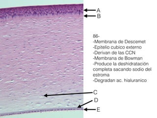 86-
-Membrana de Descemet
-Epitelio cubico externo
-Derivan de las CCN
-Membrana de Bowman
-Produce la deshidratación
completa sacando sodio del
estroma
-Degradan ac. hialuranico
A
B
C
D
E
 
