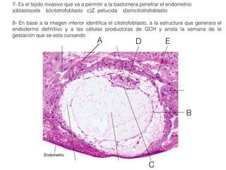 7- Es el tejido invasivo que va a permitir a la bastomera penetrar el endometrio:
a)blastocele b)citotrofoblasto c)Z. pelucida d)sincitiotrofoblasto
8- En base a la imagen inferior identiﬁca el citotrofoblasto, a la estructura que generara el
endodermo deﬁnitivo y a las células productoras de GCH y anota la semana de la
gestación que se esta cursando
A
B
C
ED
 