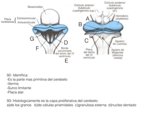 E
B
A
C
92- Identiﬁca:
-Es la parte mas primitiva del cerebelo
-Vermis
-Surco limitante
-Placa alar
93- Histologicamente es la capa proliferativa del cerebelo:
a)de los granos b)de células piramidales c)granulosa externa d)nucleo dentado
D
G
F
 