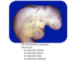 94- Se señala la siguiente
estructura:
a) placoda olfativa
b) placoda optica
c) placoda otica
d) placoda cardiaca
 