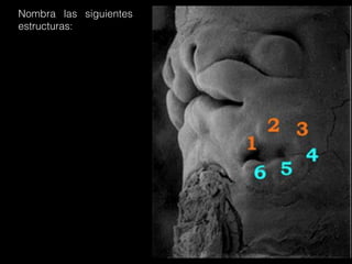 Nombra las siguientes
estructuras:
 