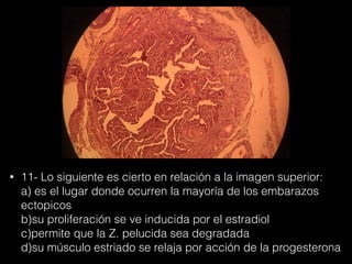 • 11- Lo siguiente es cierto en relación a la imagen superior:
a) es el lugar donde ocurren la mayoría de los embarazos
ectopicos
b)su proliferación se ve inducida por el estradiol
c)permite que la Z. pelucida sea degradada
d)su músculo estriado se relaja por acción de la progesterona
 