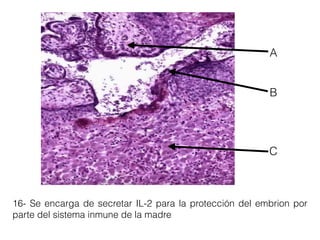 16- Se encarga de secretar IL-2 para la protección del embrion por
parte del sistema inmune de la madre
A
B
C
 
