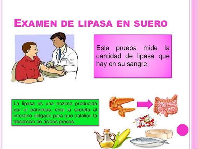 Examen y niveles de lipasa