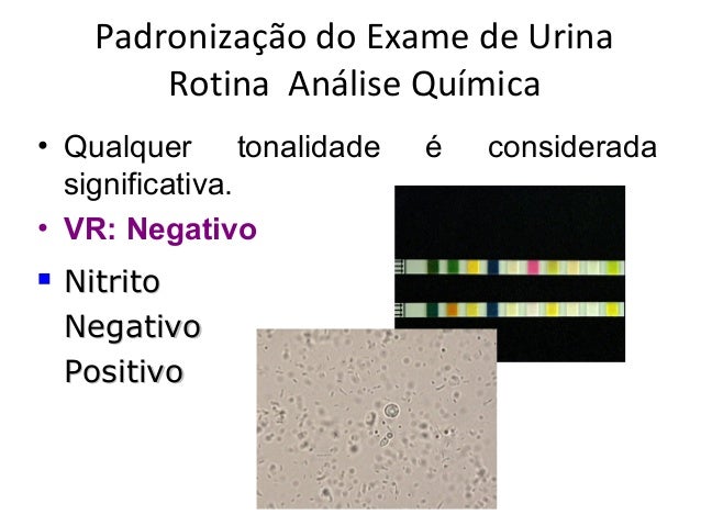 Nitrito positivo no exame de urina