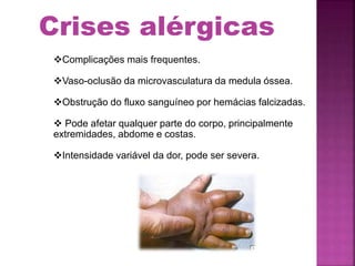 Complicações mais frequentes.
Vaso-oclusão da microvasculatura da medula óssea.
Obstrução do fluxo sanguíneo por hemácias falcizadas.
 Pode afetar qualquer parte do corpo, principalmente
extremidades, abdome e costas.
Intensidade variável da dor, pode ser severa.
Crises alérgicas
 