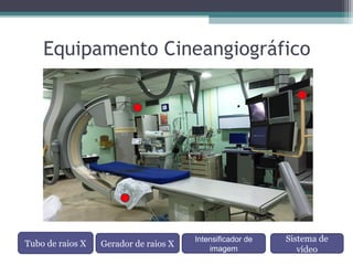 Equipamento Cineangiográfico
Gerador de raios XTubo de raios X
Sistema de
vídeo
Intensificador de
imagem
 