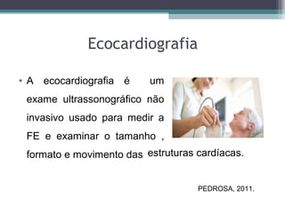 Ecocardiografia
• A ecocardiografia é um
exame ultrassonográfico não
invasivo usado para medir a
FE e examinar o tamanho ,
formato e movimento das estruturas cardíacas.
PEDROSA, 2011.
 