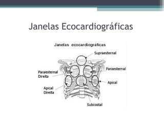Janelas Ecocardiográficas
 