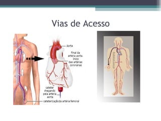 Vias de Acesso
 