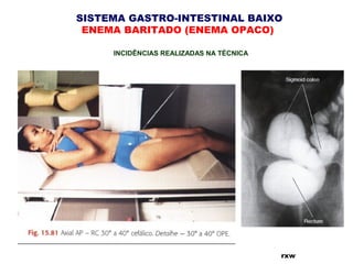 SISTEMA GASTRO-INTESTINAL BAIXO
ENEMA BARITADO (ENEMA OPACO)
INCIDÊNCIAS REALIZADAS NA TÉCNICA
rxw
 
